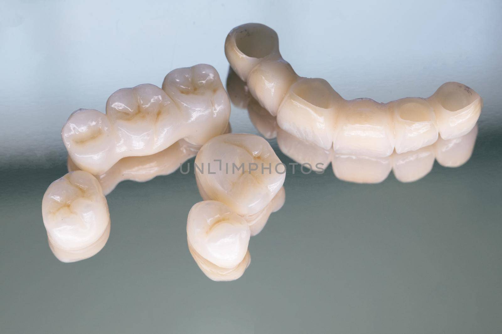 Ceramic zirconium in final version. Staining and glazing. Precision design and high quality materials. Metal Free Ceramic Dental Crowns