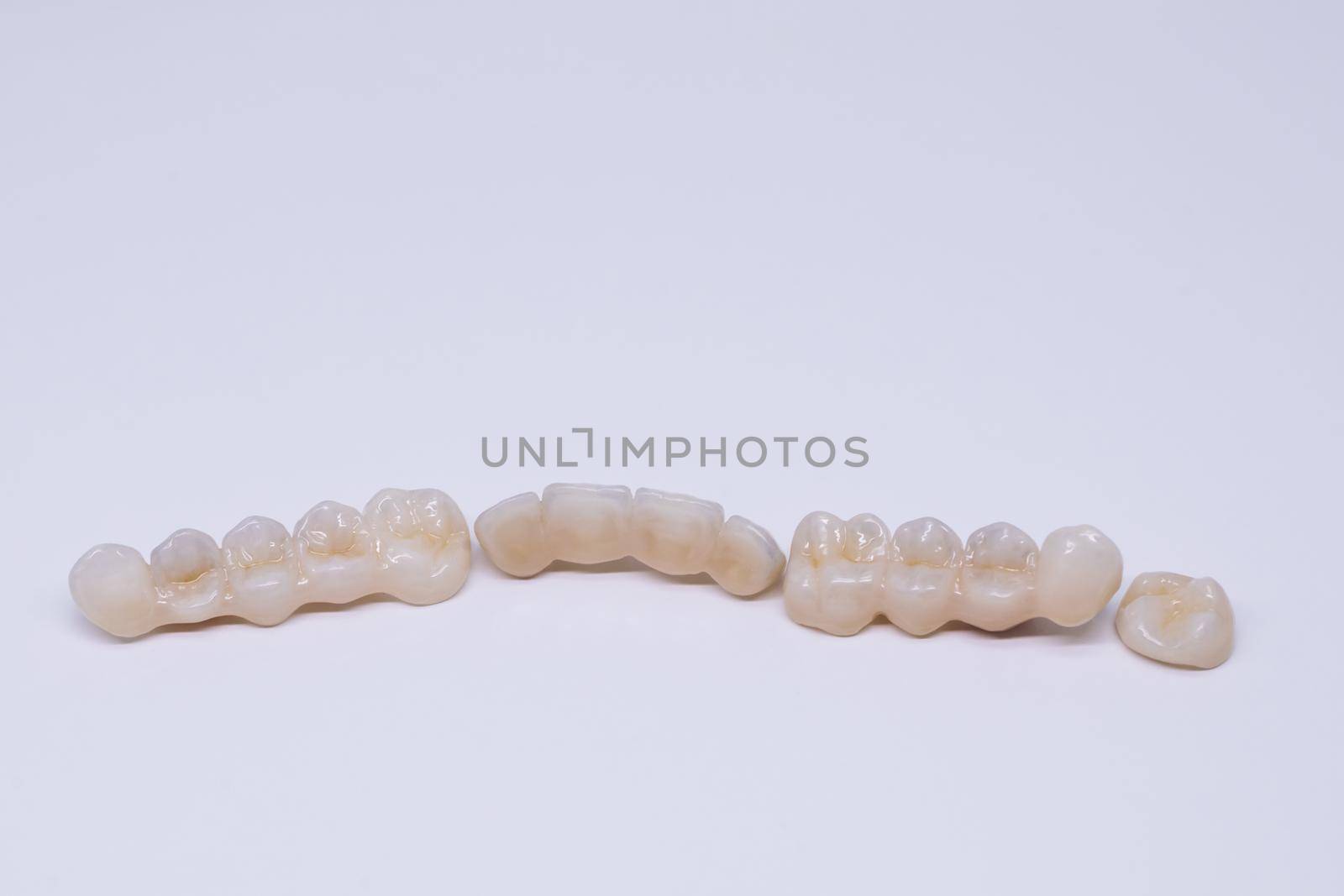 Beautiful ceramic teeth. Porcelain crown and bridge. Dental ceramic bridge in wite background. Metal free ceramic dental crowns