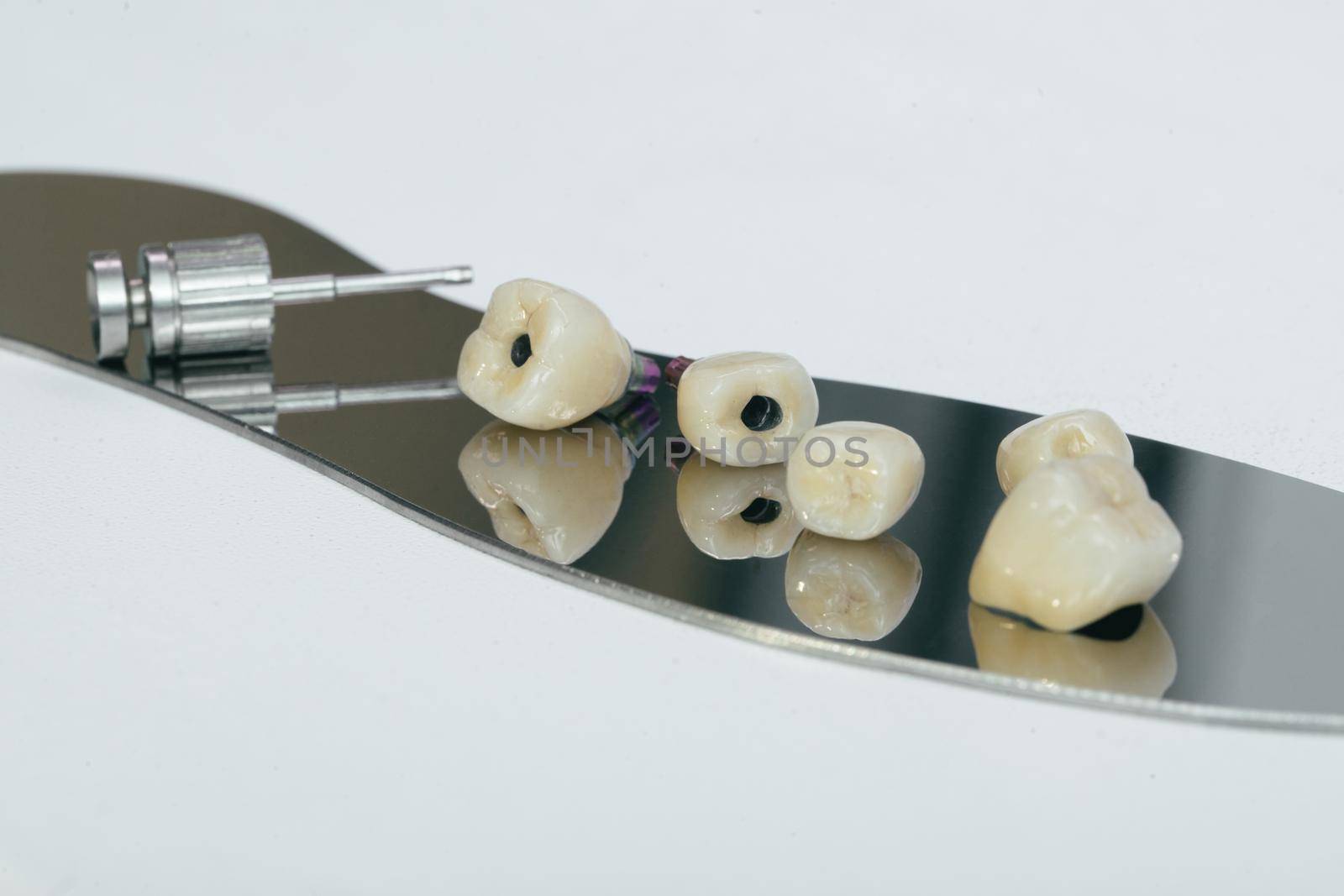 Monolithic screw retained zirconium crown on the implant, a screw and a manual key for screwing the crown. Zirconium crown and zirconium hybrid abutment.