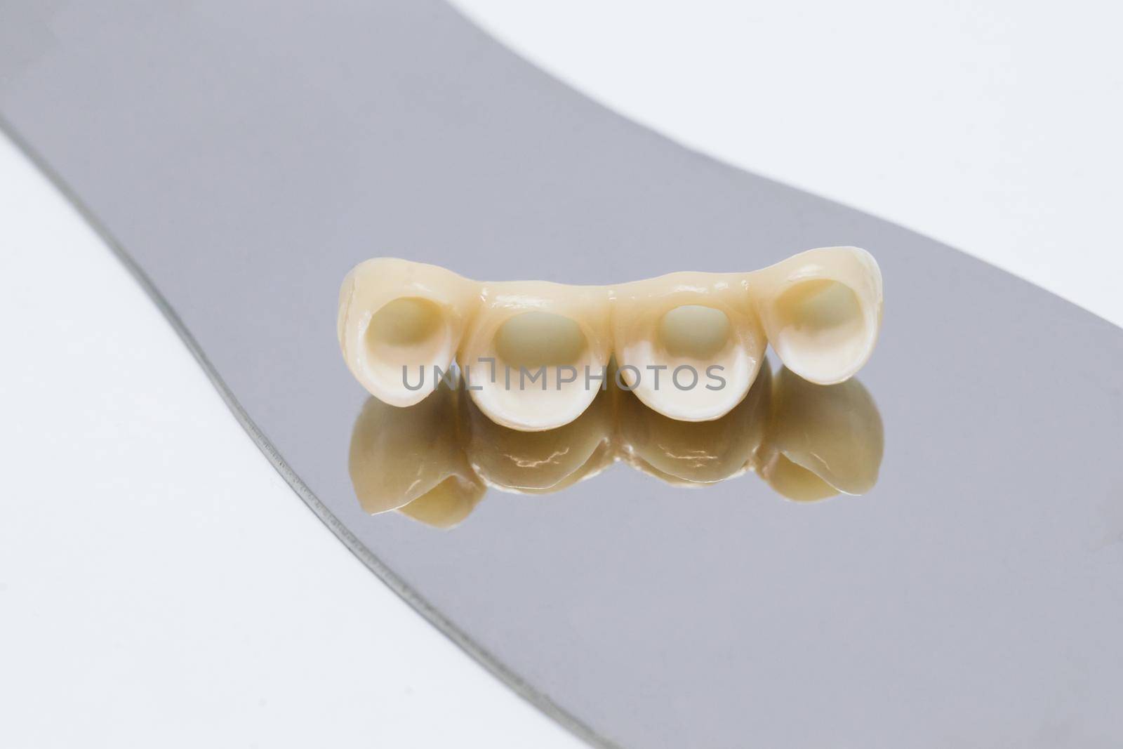 Metal free ceramic dental crowns. Dental ceramic veneers and crowns by uflypro