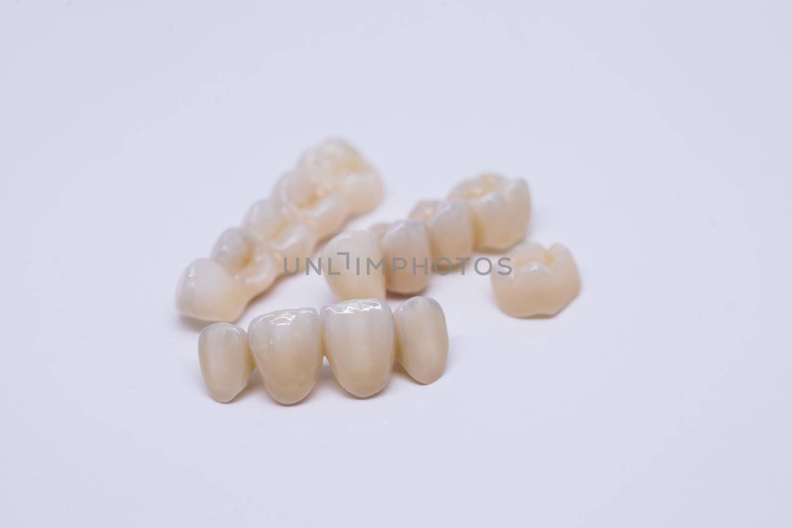 Metal Free Ceramic Dental Crowns. Dental bridge isolated on wite made of ceramic porcelain. Aesthetic restoration of tooth loss. Ceramic zirconium.