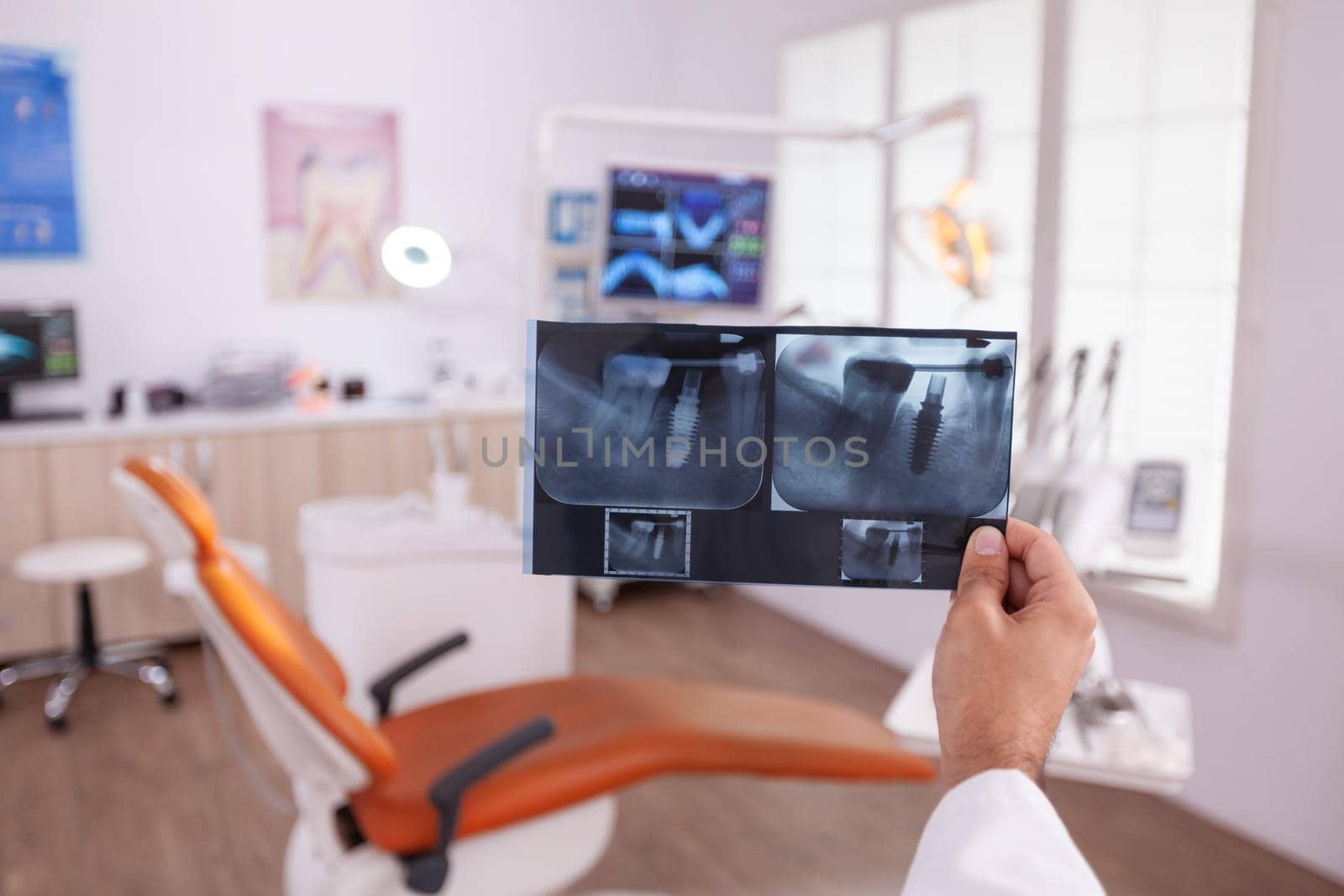 Orthodontist radiologist doctor holding teeth jaw surgery radiography by DCStudio