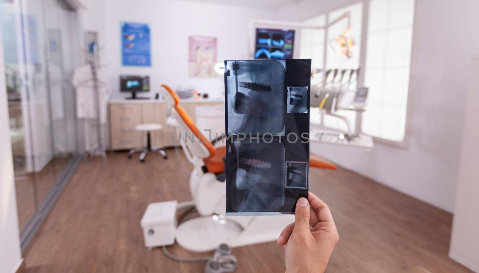 Orthodontist man doctor holding teeth medical radiography planning healthcare teethcare treatment by DCStudio