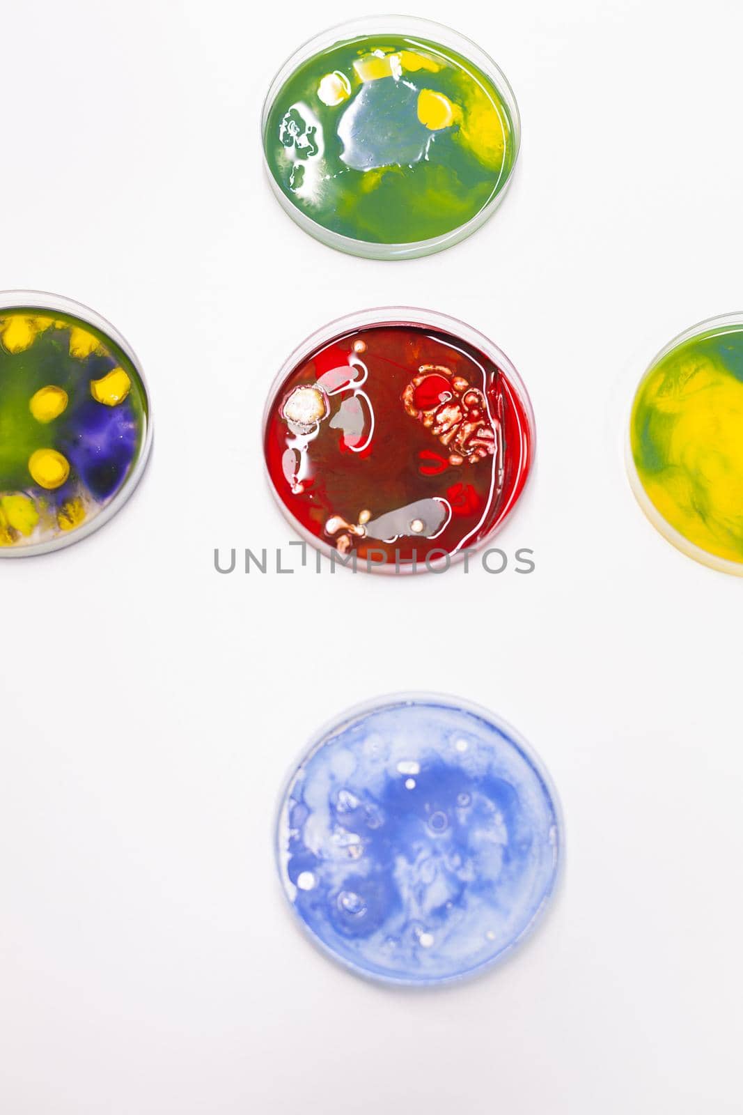 Mixed of bacteria colony in petri dish standing on table in biological scientific hospital laboratory. by DCStudio