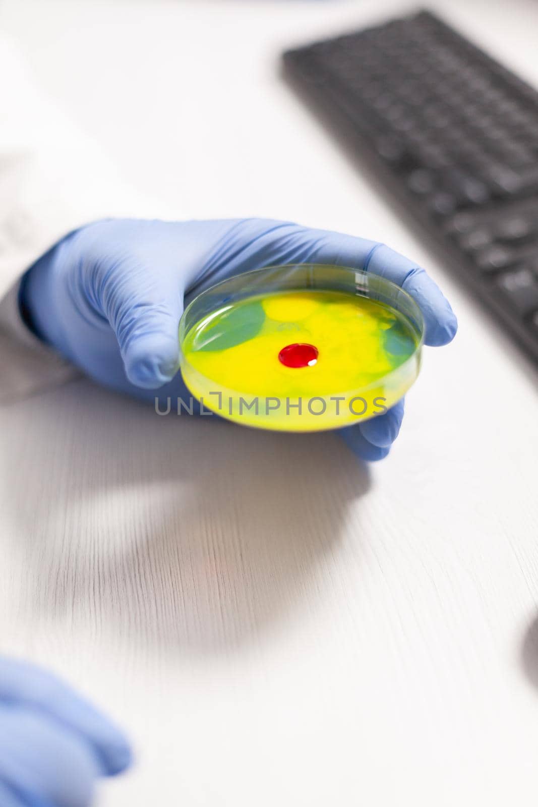 Close upf scientist holding petri dish with blood sample during vaccine research. Team of researchers examining virus evolution using high tech for vaccine development.