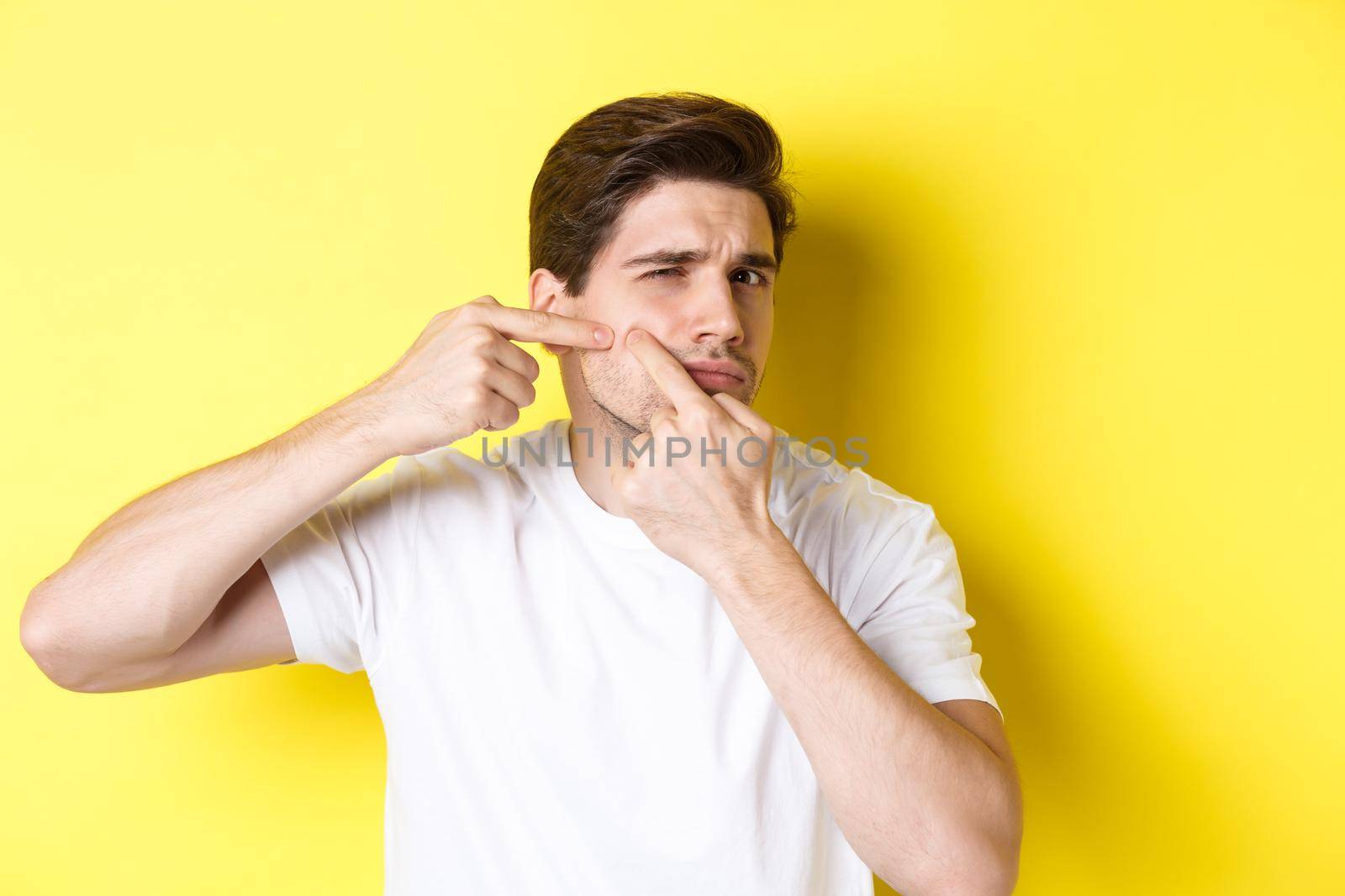 Young man pop a pimple on cheek, standing over yellow background. Concept of skin care and acne.