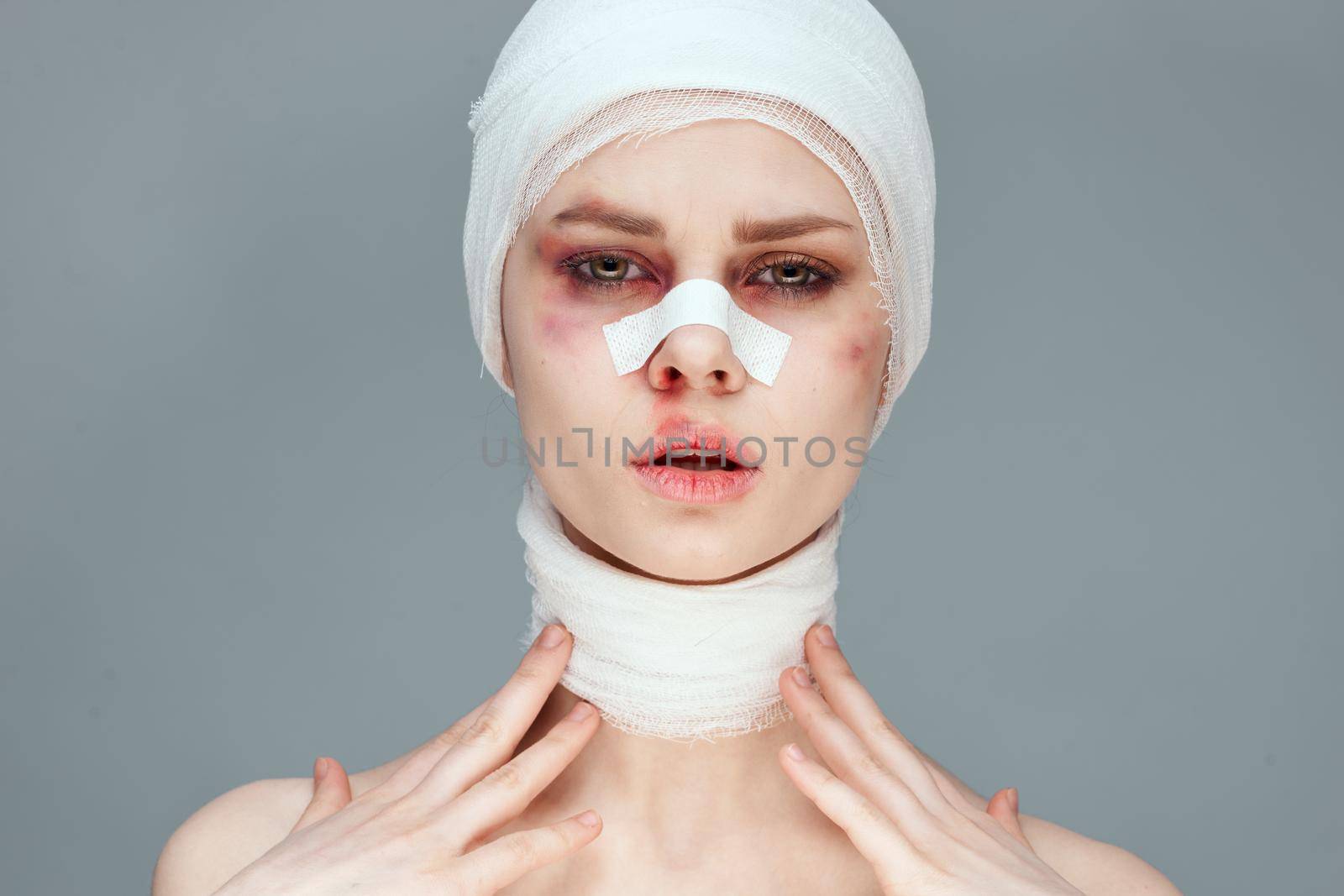 female patient plastic surgery operation bare shoulders studio lifestyle by Vichizh