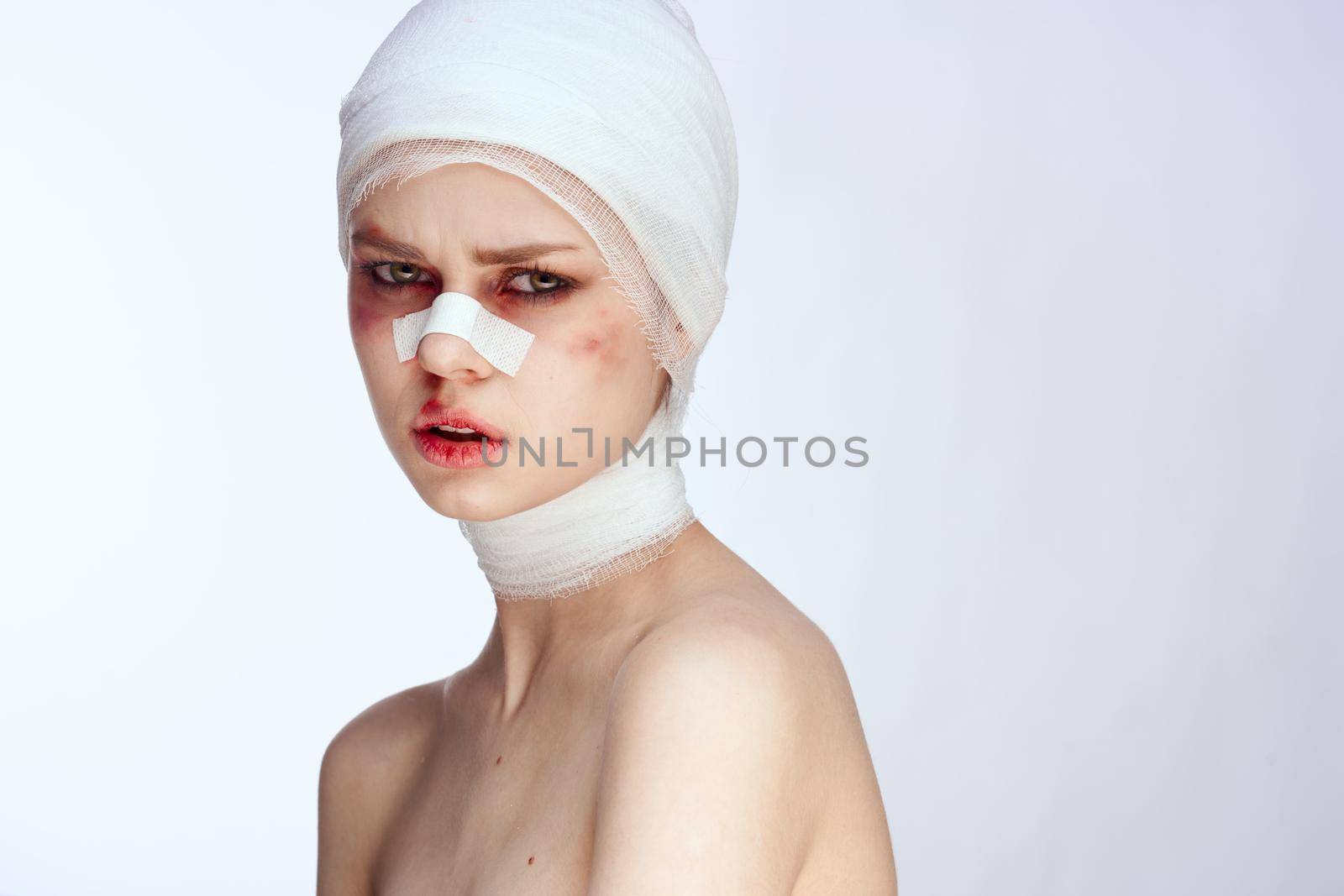emotional woman bruised face medicine treatment injury close-up by Vichizh