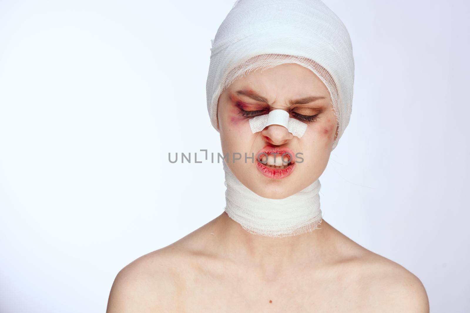 woman plastic surgery operation bare shoulders light background. High quality photo