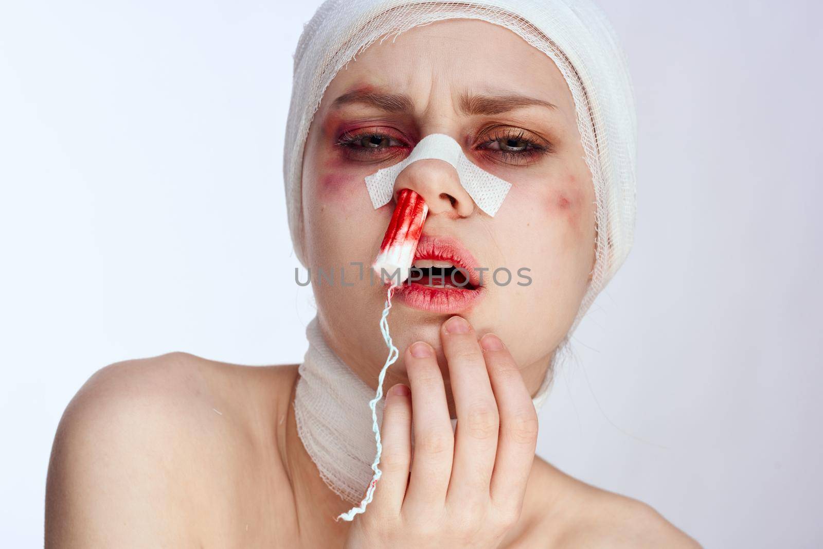 a person tampon in the nose with blood injured face close-up by Vichizh