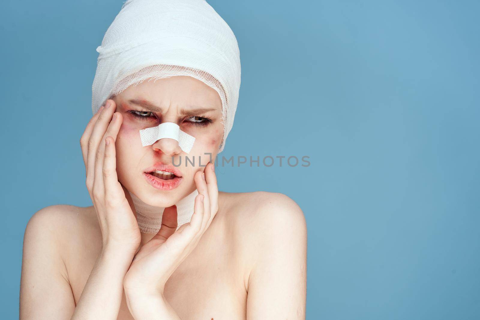 woman bruised face medicine treatment injury isolated background by Vichizh