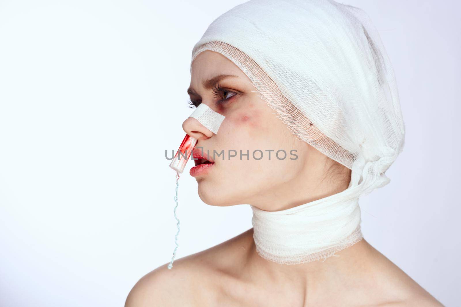 female patient plastic surgery operation bare shoulders isolated background by Vichizh