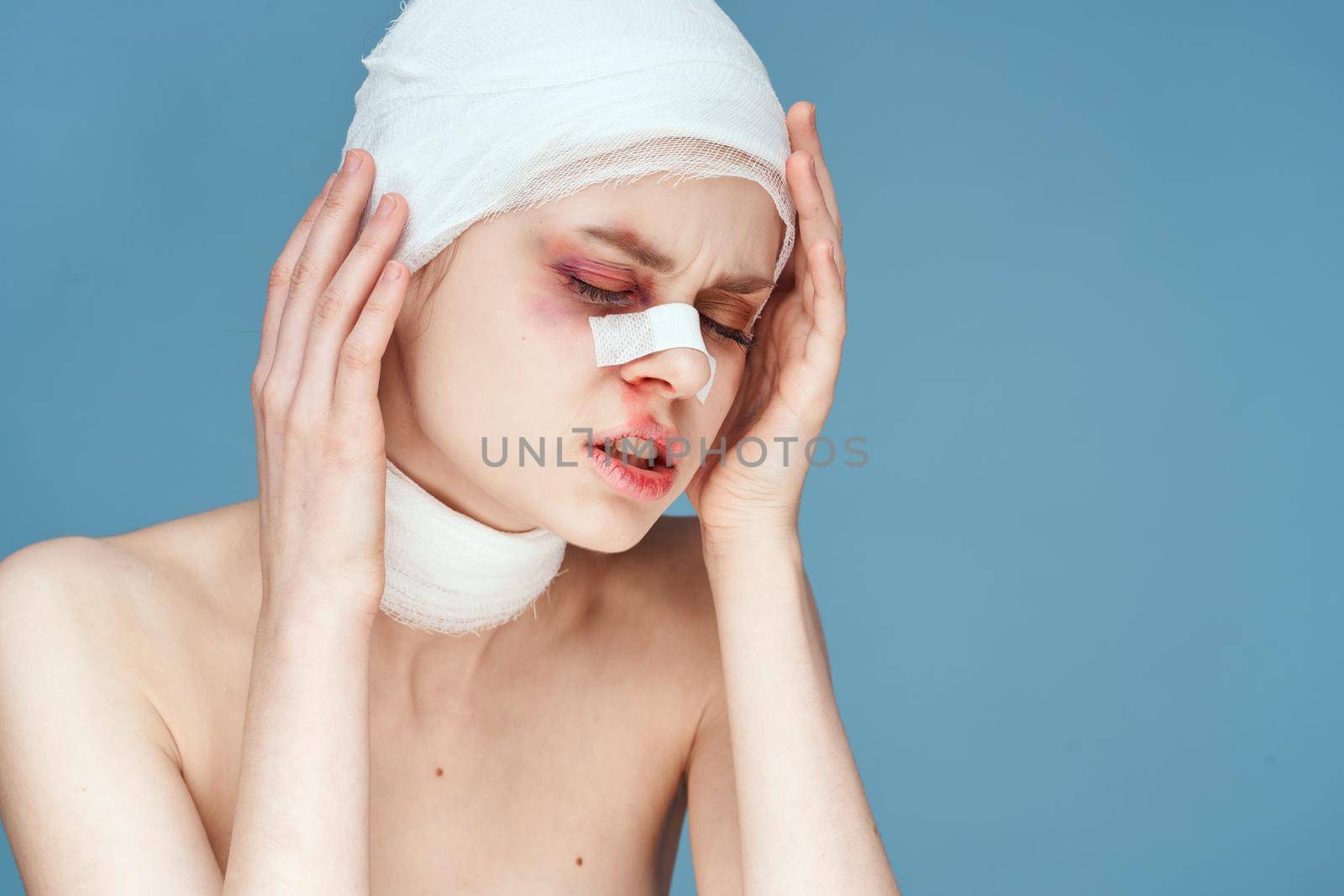 portrait of a woman bandaged face bruises bare shoulders discontent studio lifestyle by Vichizh