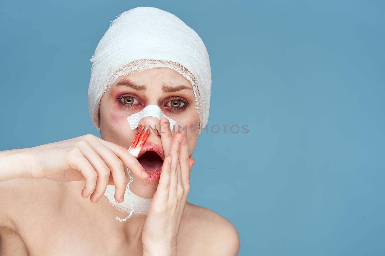 female patient plastic surgery operation bare shoulders studio lifestyle. High quality photo