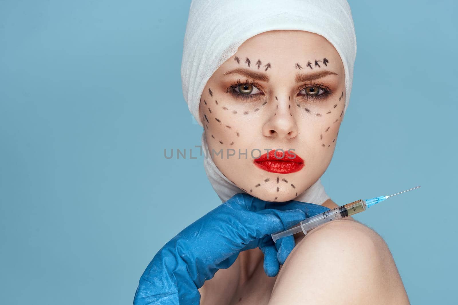 beautiful woman in blue gloves syringe in hands contour on the face lifting close-up by Vichizh