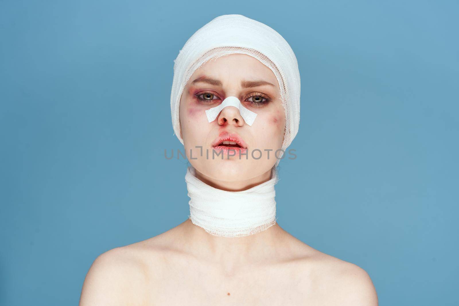 female patient health problems trauma bruises emotions blue background. High quality photo