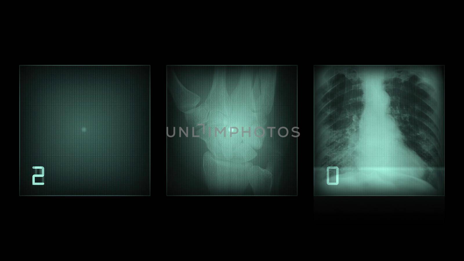 3d illustration - x-ray panels on black background