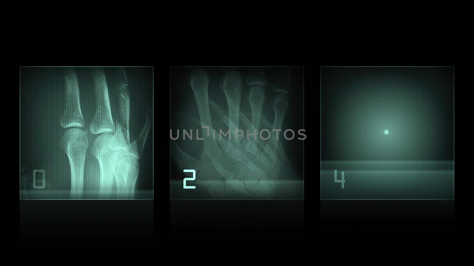 3d illustration - x-ray panels on black background by vitanovski