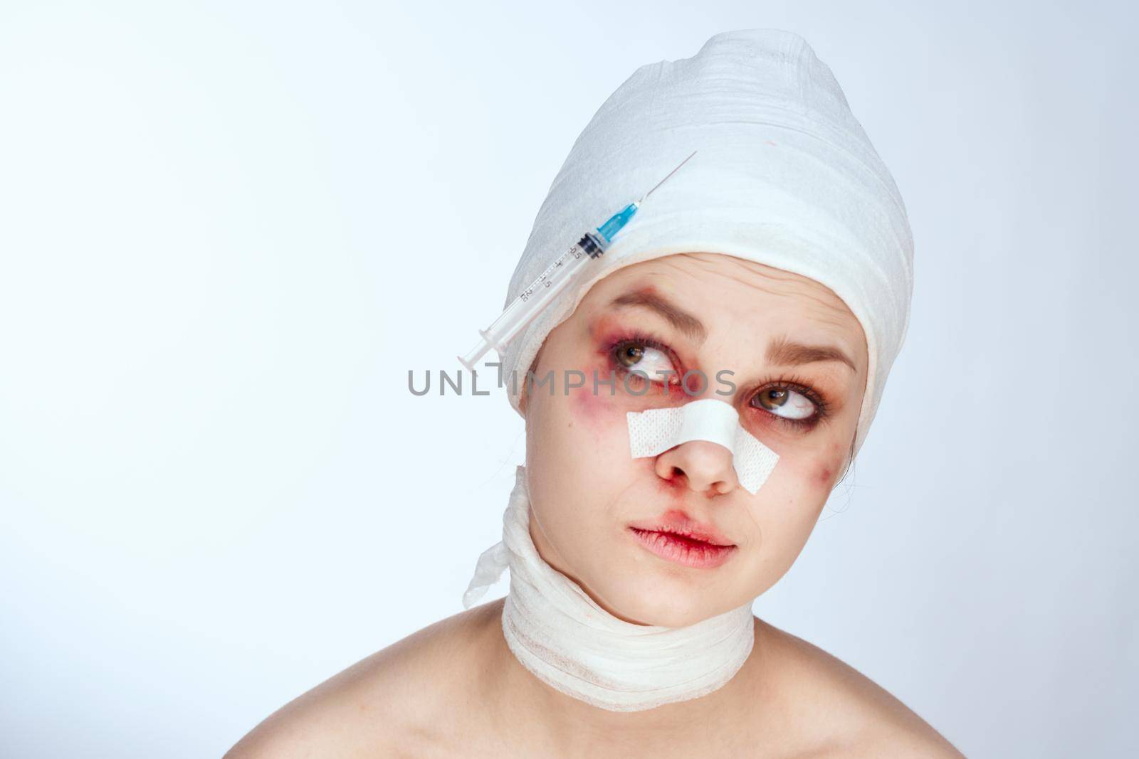 woman bruised face medicine treatment injury isolated background. High quality photo