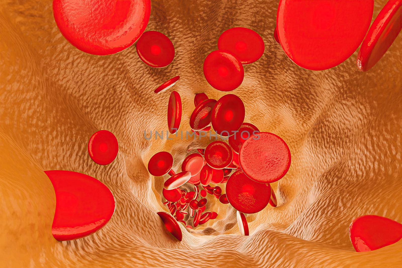 interior of a vein full of cholesterol with red blood cells stuck in it. 3d rendering