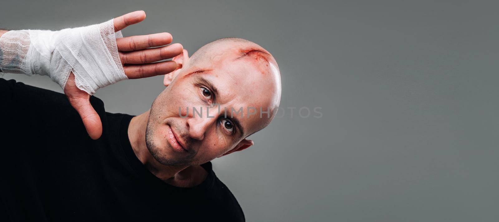 A battered man with his arm wrapped in a bandage stands on a gray background by Lobachad