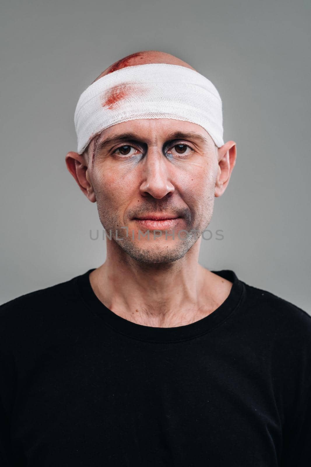 Against a gray background stands a battered and battered man in a black T-shirt with his head wrapped in a bandage.