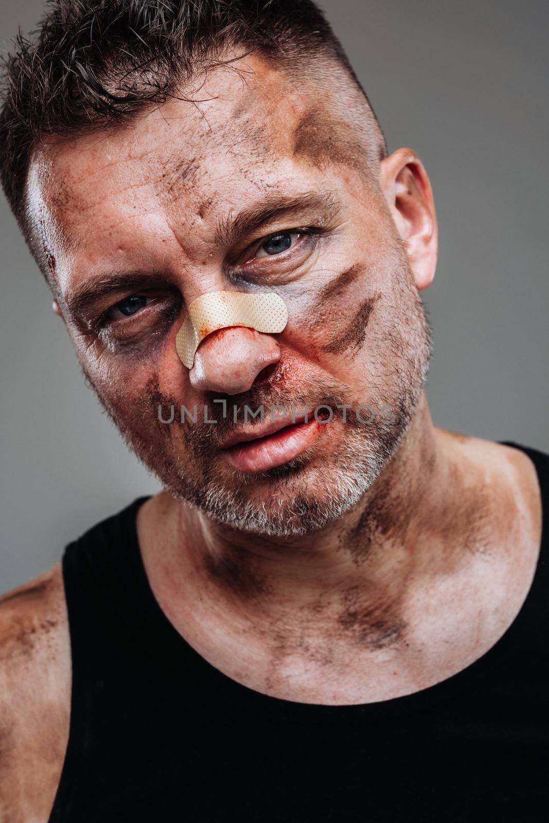 a battered man in a black T shirt who looks like a drug addict and a drunk stands against a gray background.