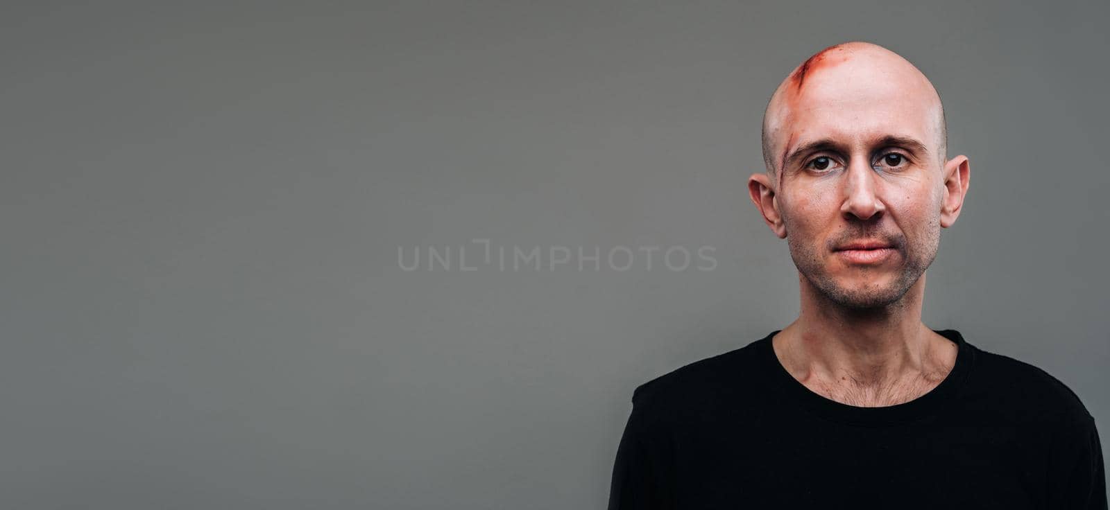 A battered man in a black T shirt who looks like a drug addict and a drunkard stands on a gray background.