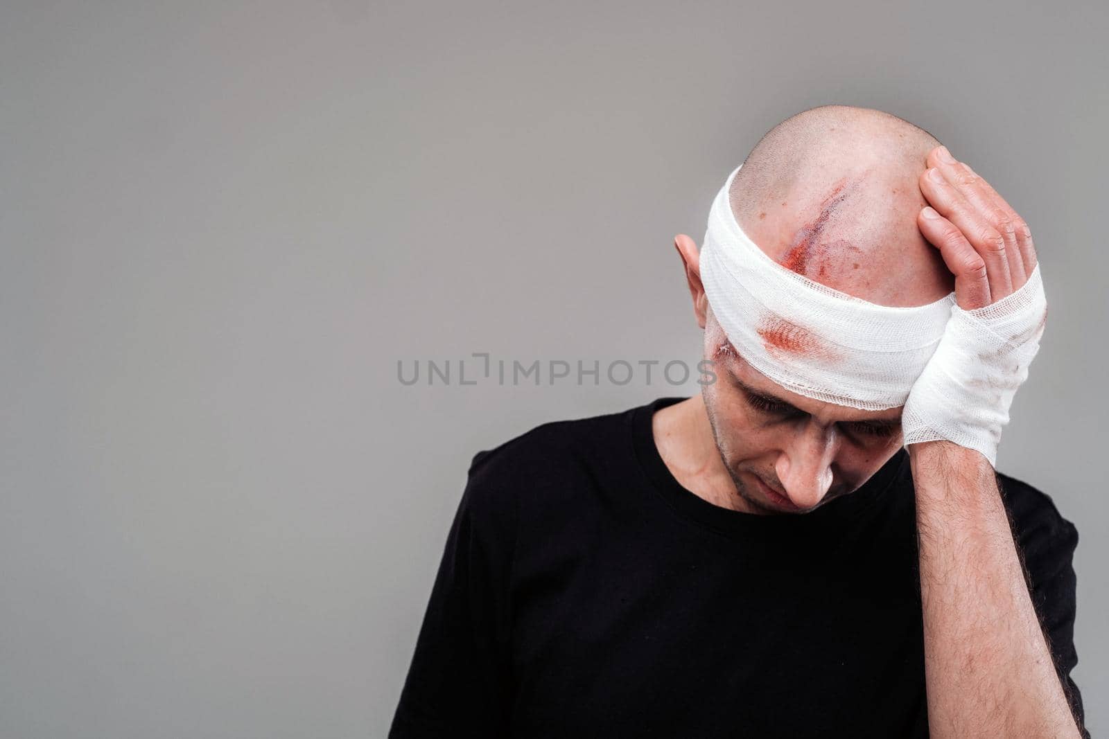 A battered and battered man in a black T-shirt stands against a gray background, holding his aching head with his hands wrapped around it.