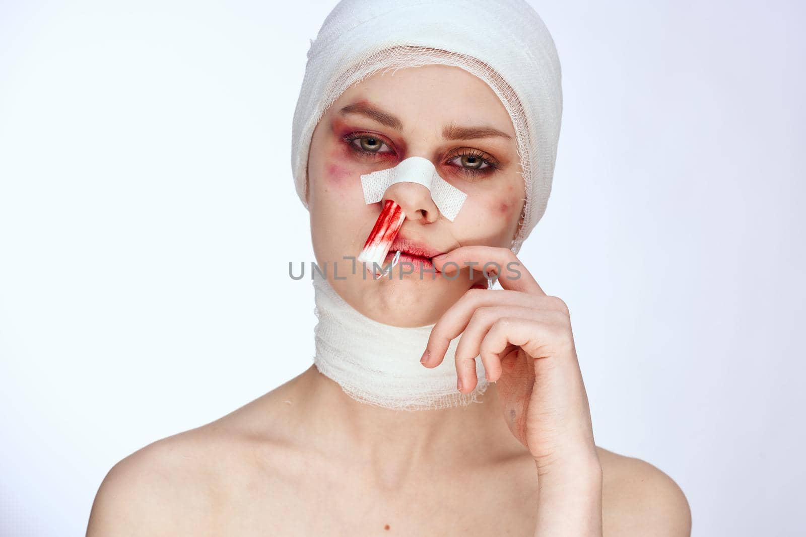 female patient tampon in the nose with blood injured face isolated background by Vichizh