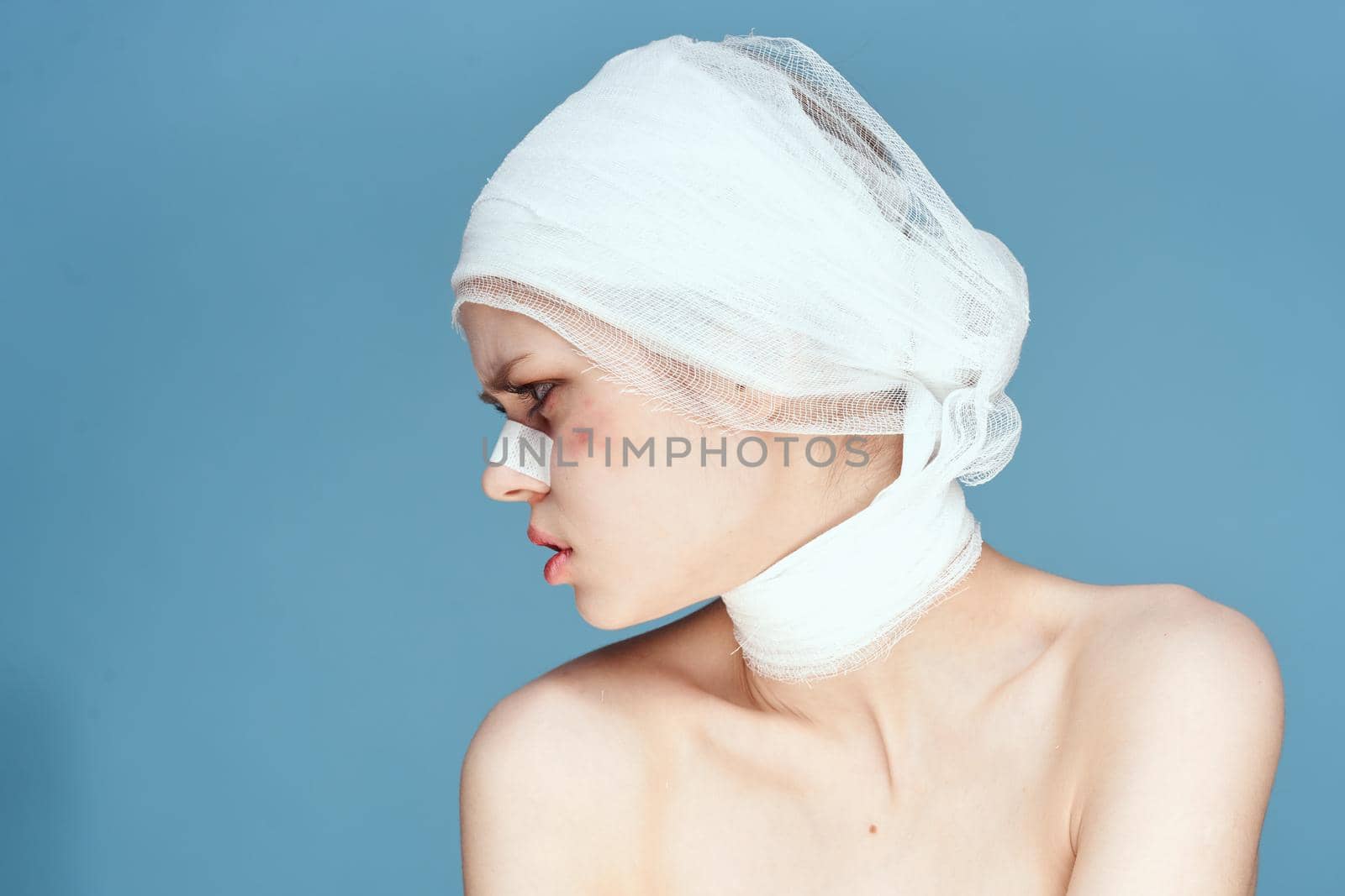 portrait of a woman bandaged face bruises bare shoulders discontent studio lifestyle by Vichizh