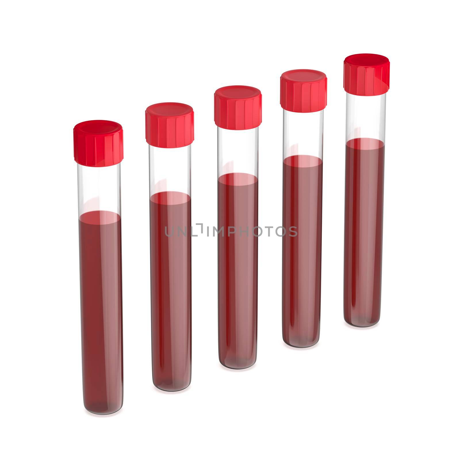 Test tubes with blood by magraphics