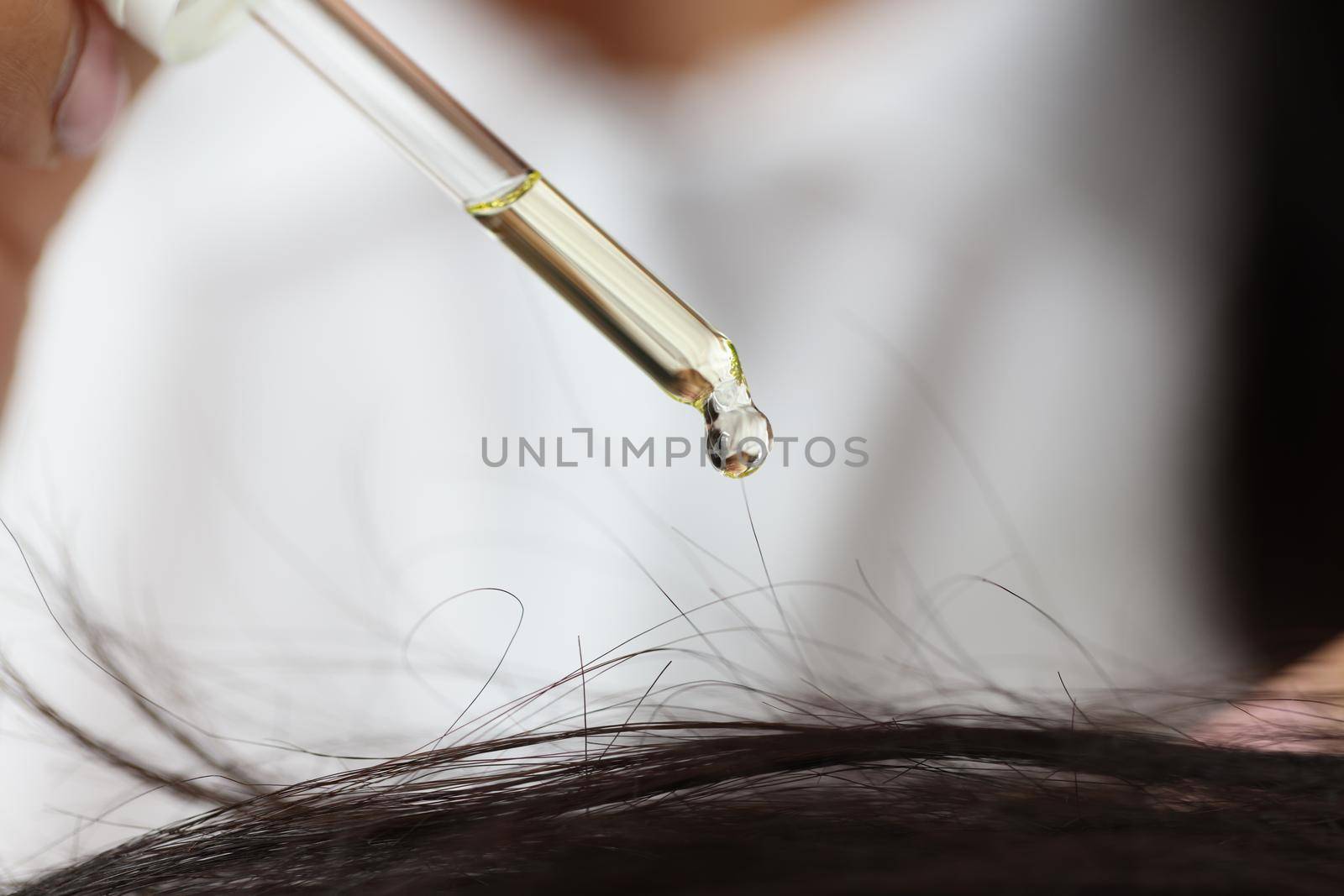 Oil drips from a pipette onto the hair on the head, close-up. Hair restoration in the salon. Cosmetic procedures against alopecia, split ends