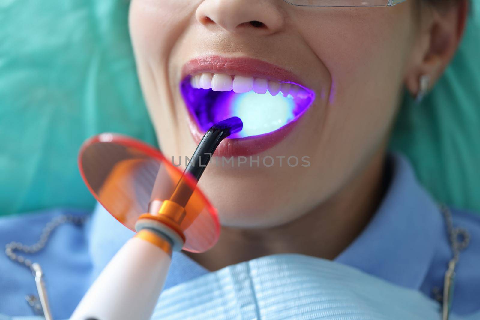 Young woman at the dentist's office, mouth close-up. Sanitation of the oral cavity, examination by a doctor, cleaning of the enamel of the teeth