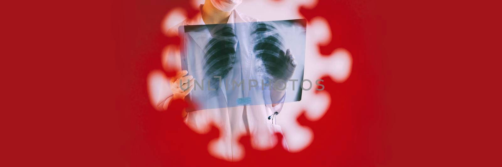 Banner. A hole in a piece of red paper in the shape of a coronavirus. The doctor is holding an X-ray of his lungs. by Rodnova
