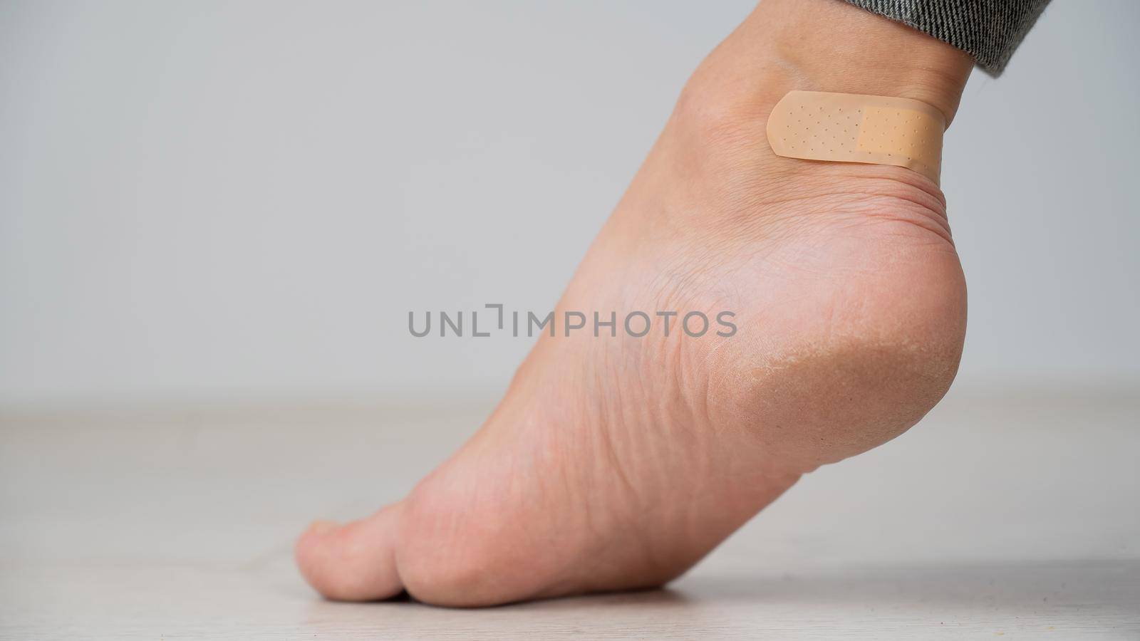 A woman seals a corn on her leg with a plaster. The girl rubbed her leg with uncomfortable shoes