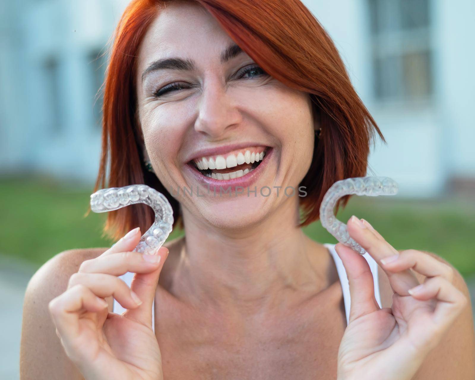 Red-haired Caucasian woman holding transparent mouthguards for bite correction outdoors. A girl with a beautiful snow-white smile uses silicone braces.