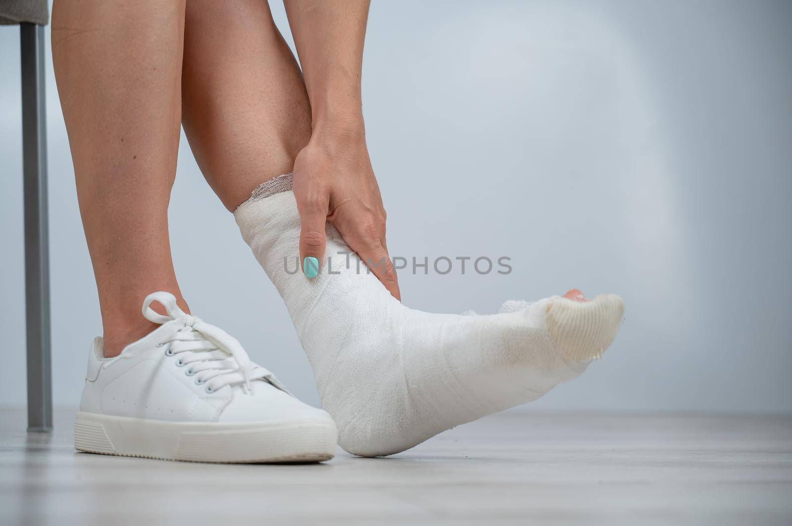 Close-up of female legs with plaster cast. A woman with a broken leg sits on a chair by mrwed54