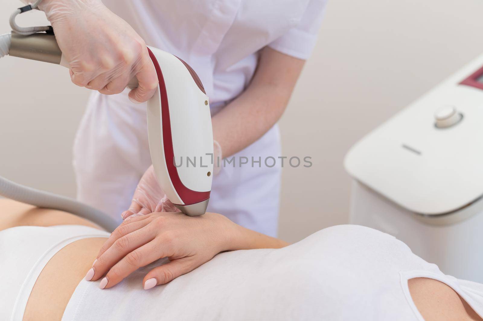 Woman on laser epilation procedure. Hardware removal of unwanted vegetation on hands.