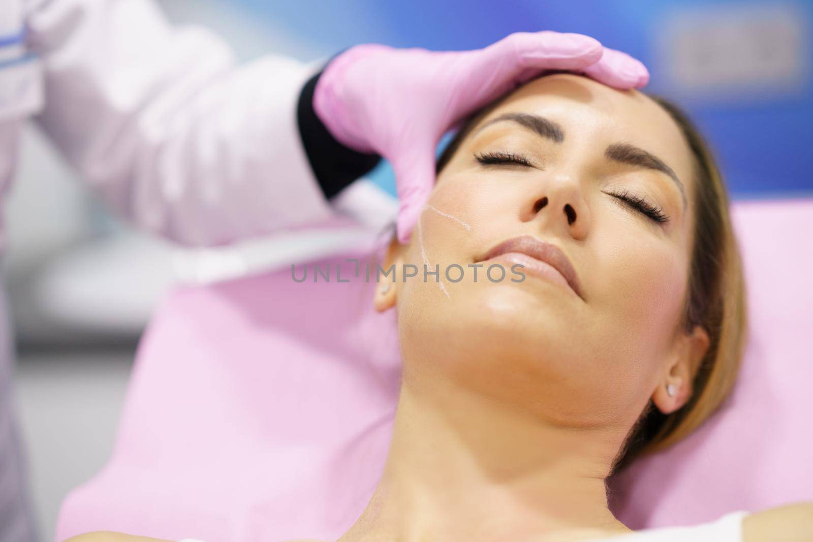 Doctor painting the area of a woman's face where the PDO suture treatment threads will be injected. by javiindy