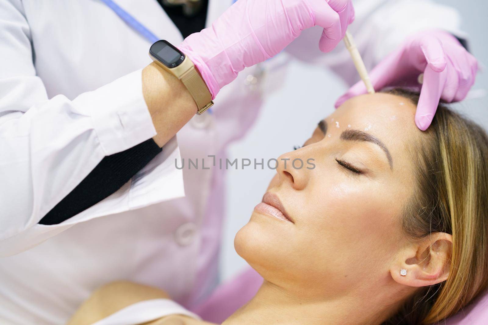 Aesthetic doctor painting on the face of his middle-aged patient the areas to be treated with botox.
