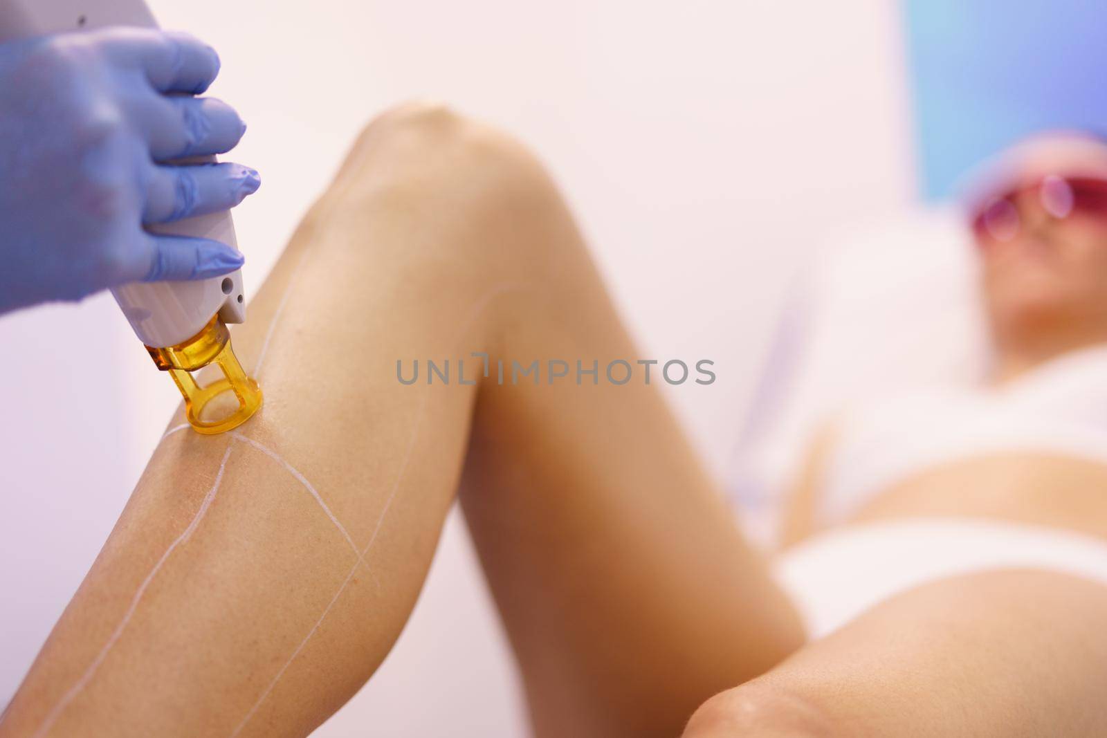 Woman receiving legs laser hair removal at a beauty center. Laser depilation treatment in an aesthetic clinic.