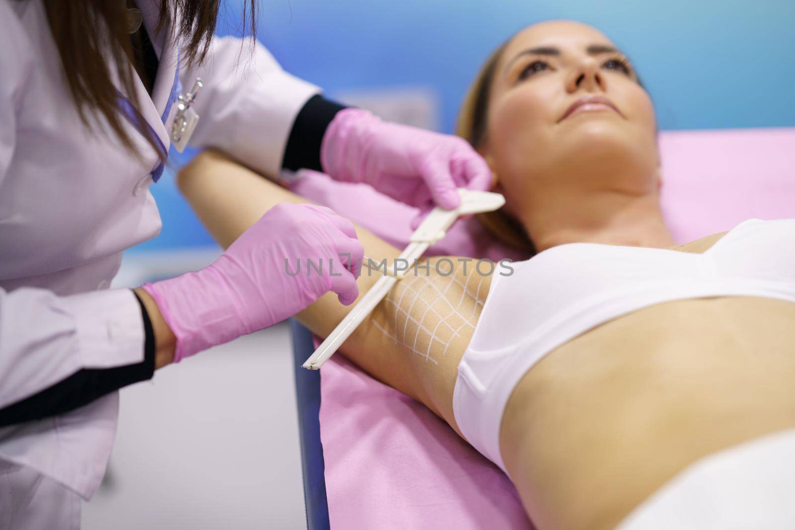 Doctor painting on the armpit of her patient, the area to be treated for hyperhidrosis. by javiindy