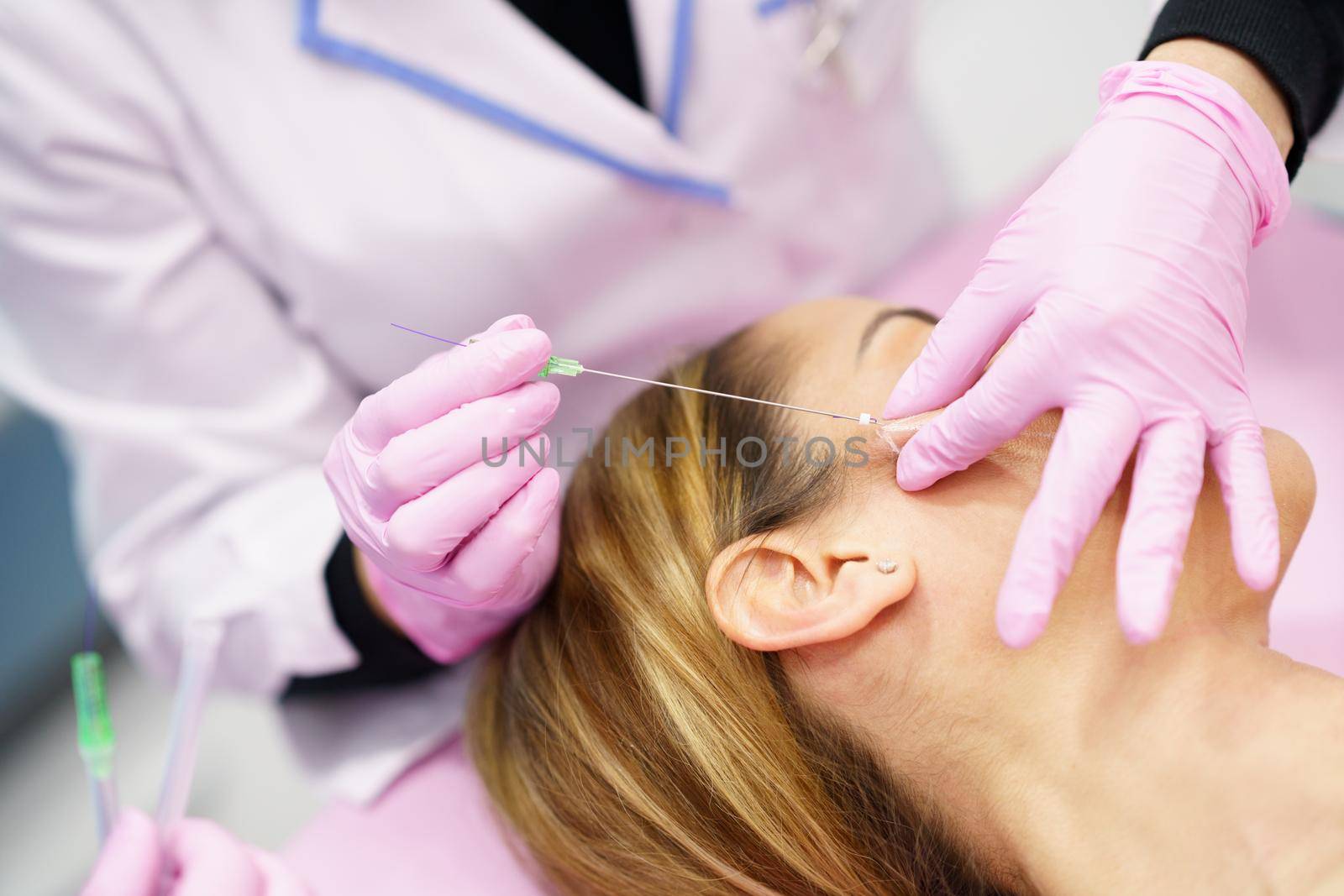 Doctor injecting PDO suture treatment threads into the face of a middle-aged woman.