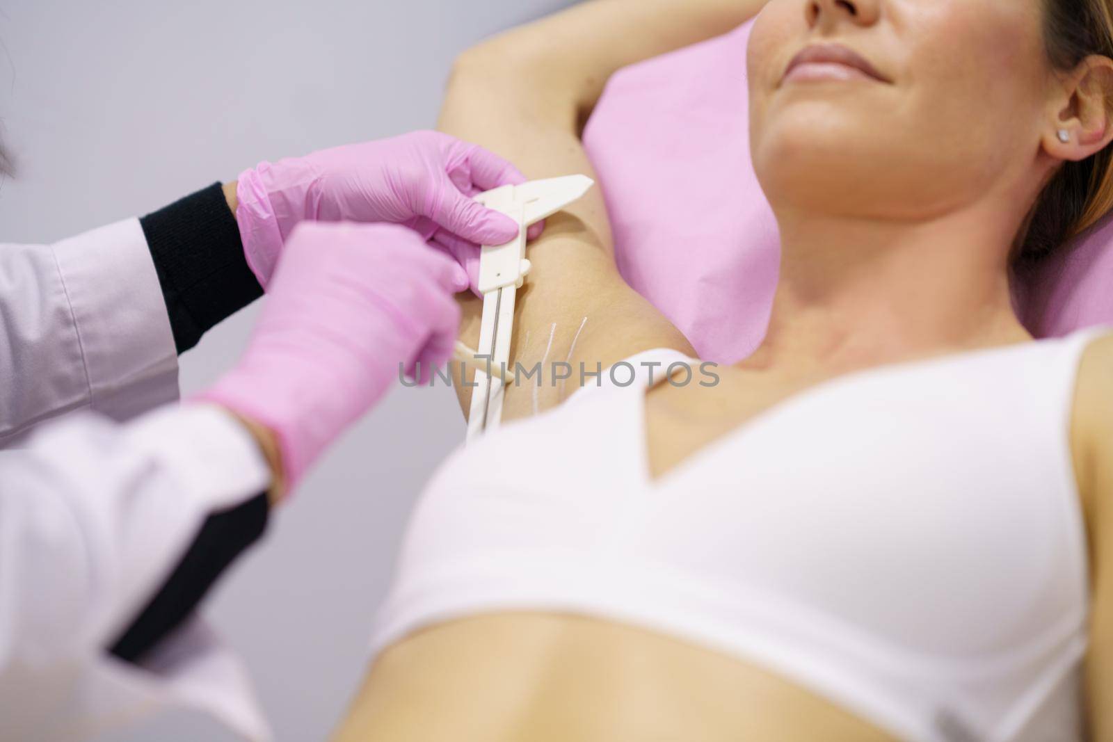 Doctor painting on the armpit of her middle-aged patient, the area to be treated for hyperhidrosis.