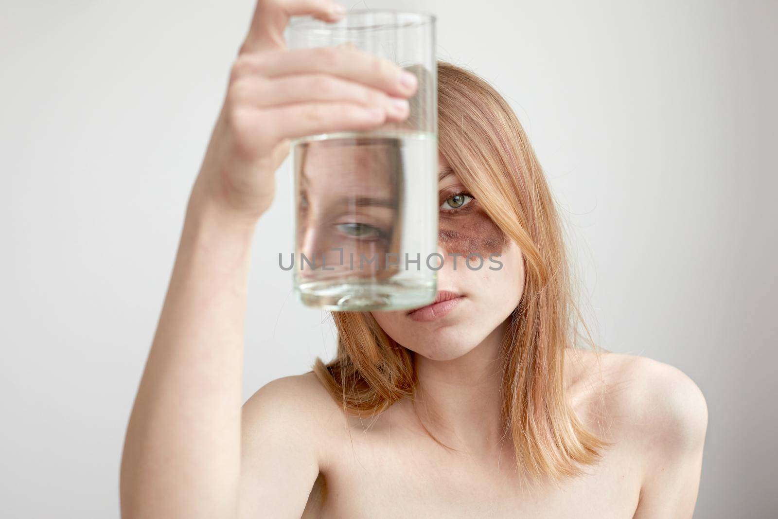 Young bare shouldered female with dark pigment spot under eye looking at camera through transparent glass with water