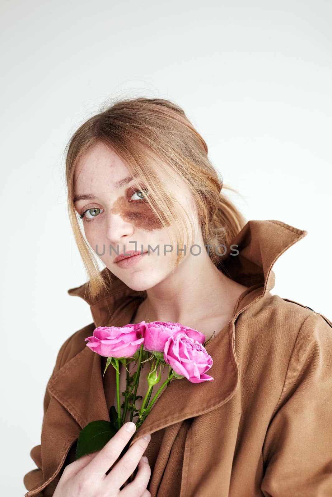 Serious lady with roses and birthmark on face in studio by Demkat
