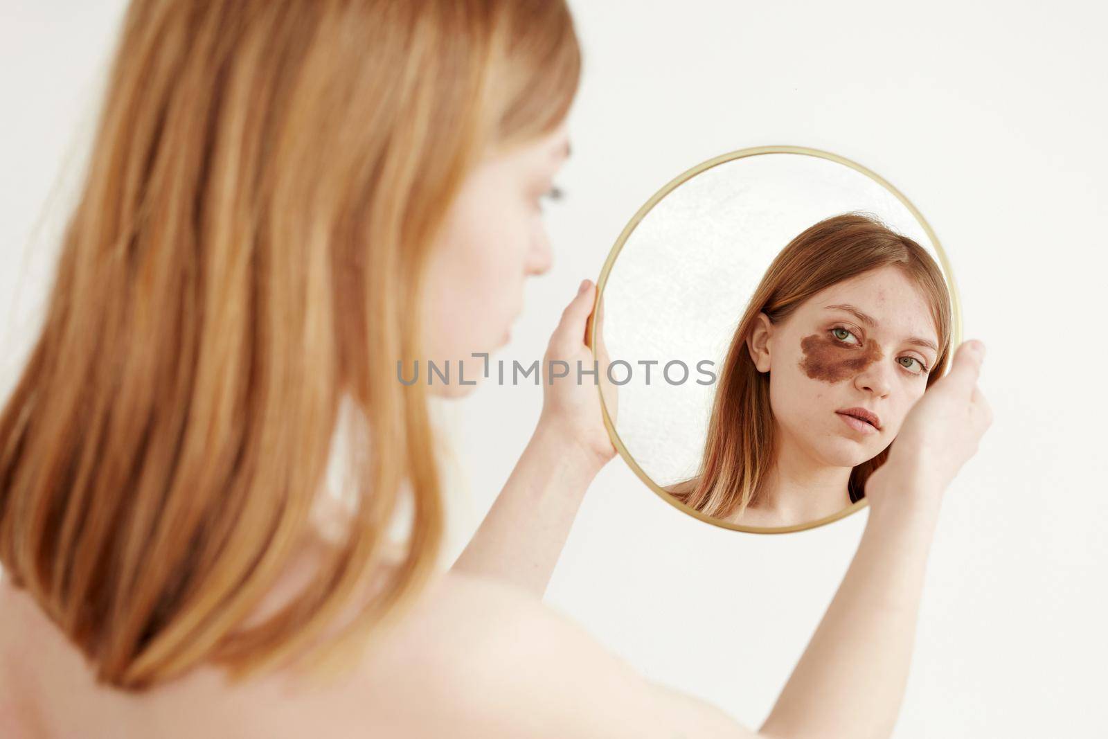 Woman with birthmark on face looking at mirror by Demkat