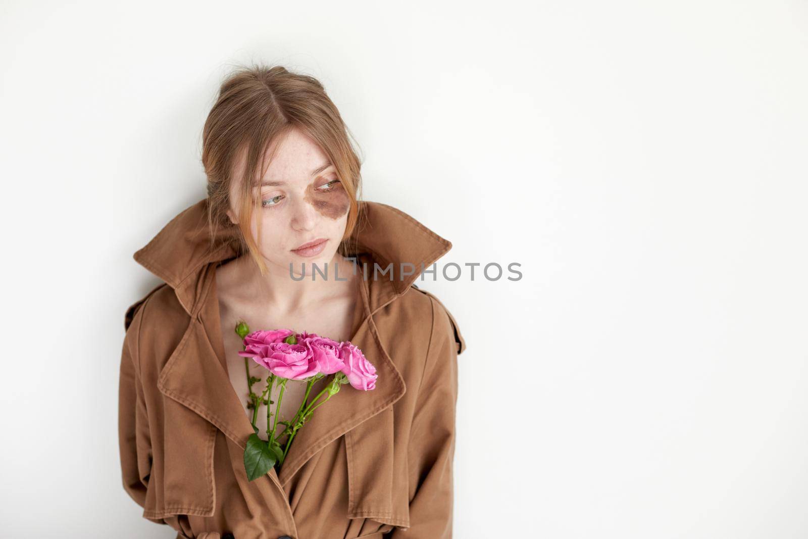 Woman with hyperpigmentation on face with flowers by Demkat
