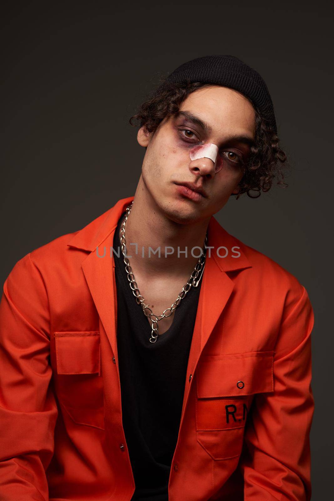 man with broken nose bruises under eyes orange shirt crime. High quality photo